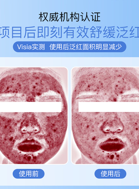 伊肤泉舒缓保湿水晶面膜