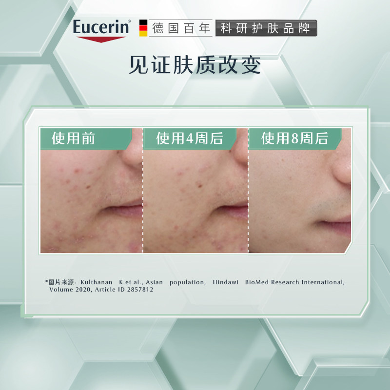 eucerin /优色林清痘净颜50ml乳液 优色林乳液/面霜