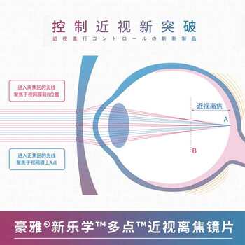 .Growth lens ຂອງເດັກນ້ອຍ Xinle school lens L lens 1.59 multi-point myopia defocus with students control degree,