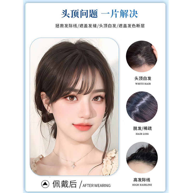 蝶型假发片女头顶补发片遮白发增发量全真人发高颅顶轻薄刘海假发