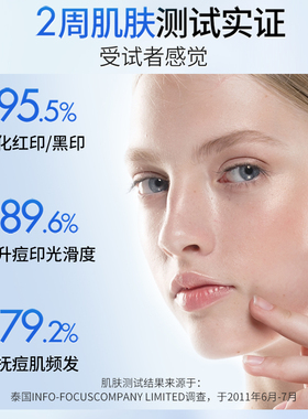 喜辽复舒缓凝胶淡化痘印瑞士品牌