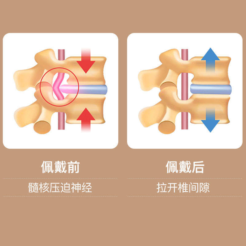 鱼跃腰椎间盘突出治疗器医用护腰带 亿家康和医疗器械护具（器械）