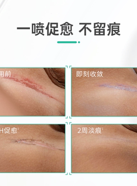 雅漾多效倍护敏肌滋润喷雾100ml