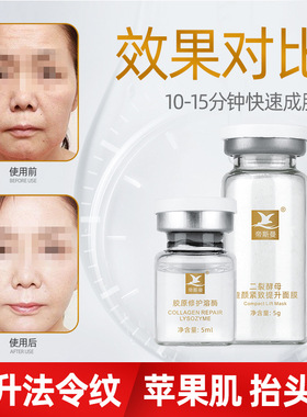 帝斯曼女巫二裂酵母紧致v脸面膜