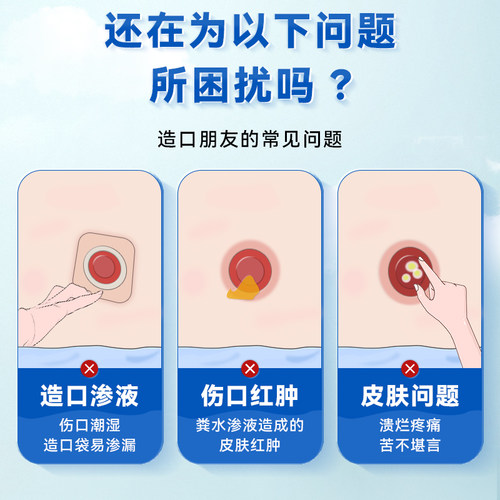 妥能造口粉防漏膏造瘘口护肤粉成人造口袋护理附件保护儿童红屁股 - 图0