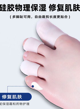 灰指甲上药套脚指抹药上药防护套灰指甲脚趾保护套防手茧脚趾头套