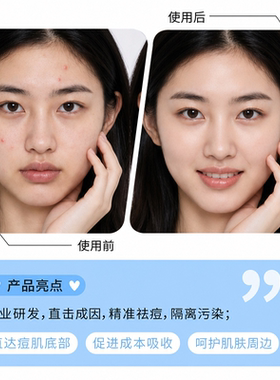 程十安星星痘痘贴水胶体吸液净痘隔污染遮瑕隐形可上妆可爱祛痘贴