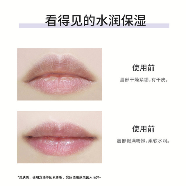 Next day delivery! American Bilexi small blue can