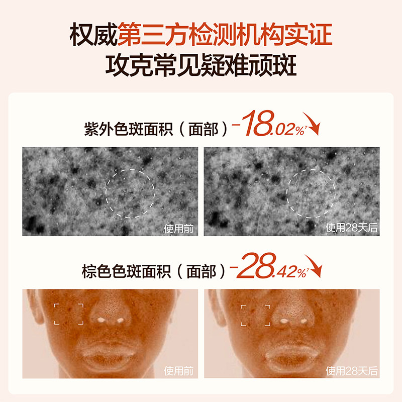 HBN原白霜美白面霜熊果苷淡斑精华霜保湿补水祛斑清爽修护女