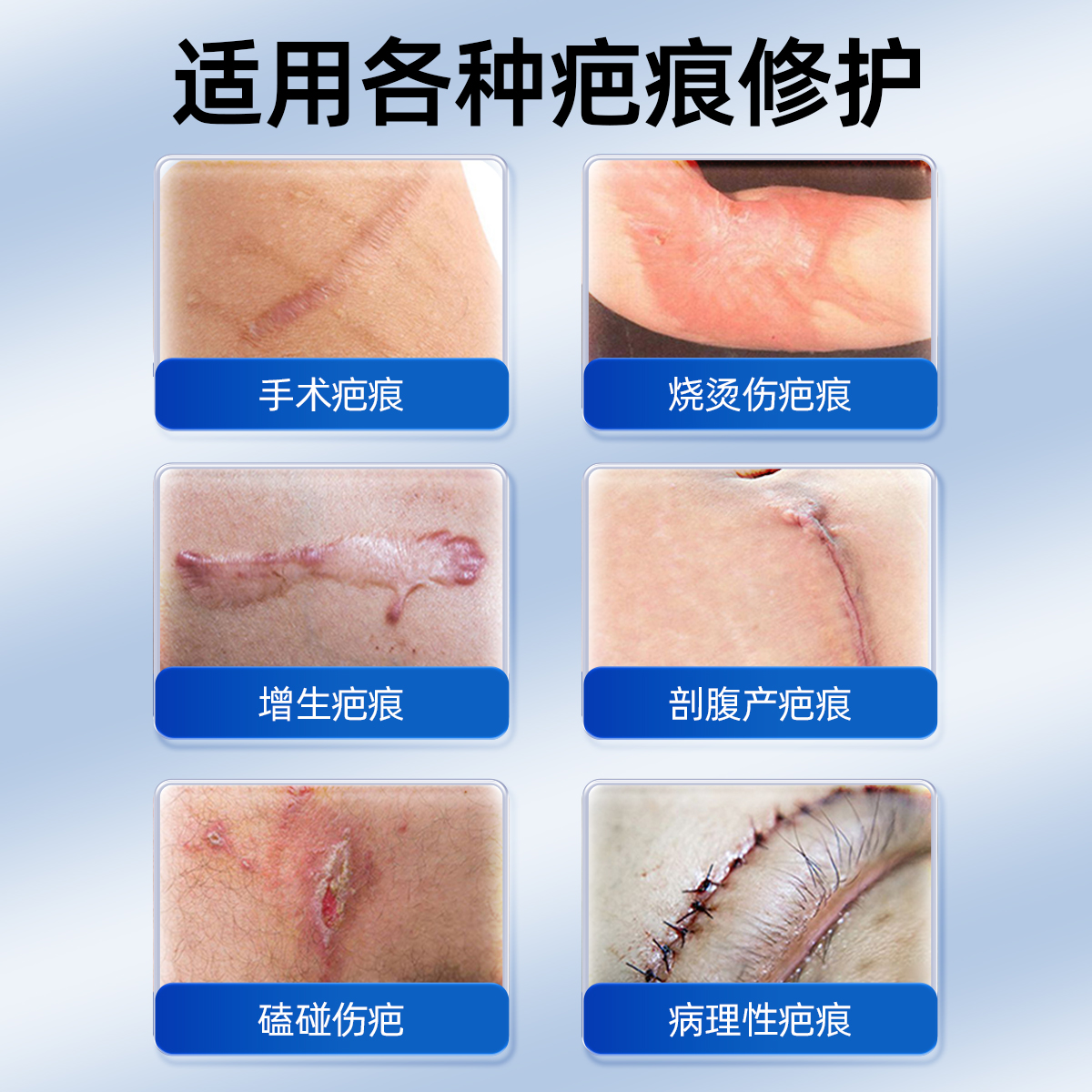 仁和祛疤膏修复凝胶去除疤痕烫伤伤疤淡化淡疤印黑印病理疤痕伤痕