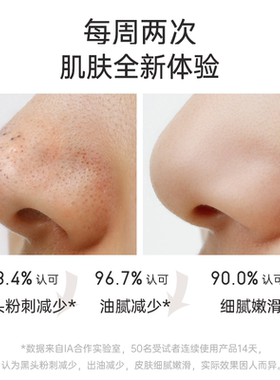 infiniteAloe角鲨烷北欧泥面膜