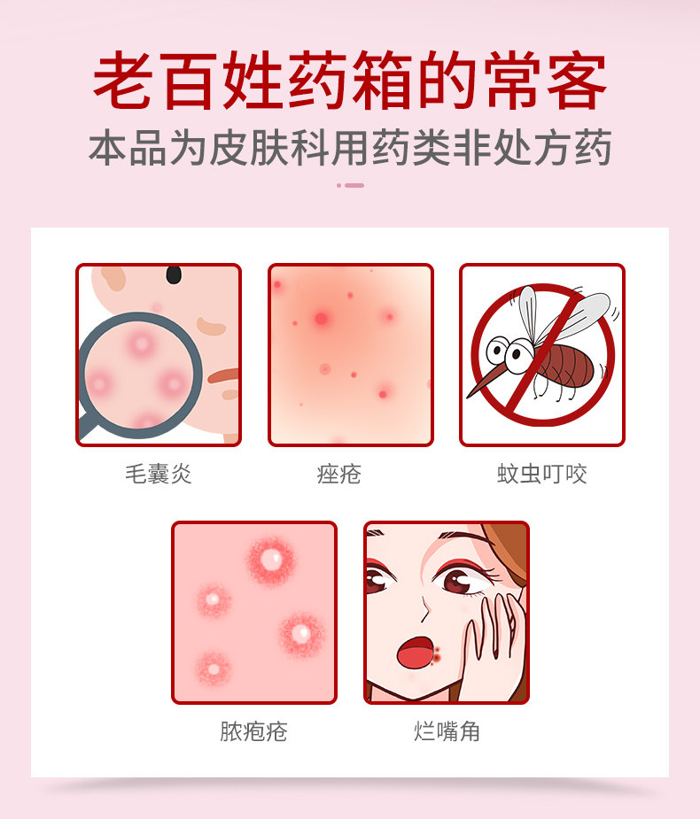 马应龙正品红霉素软膏药烫伤抗菌消炎痤疮脓包溃疡感染官方旗舰店