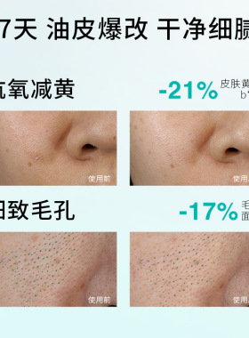 【侯明昊同款】珀芙研油痘调理平衡乳 控油祛痘去闭口油皮水乳液