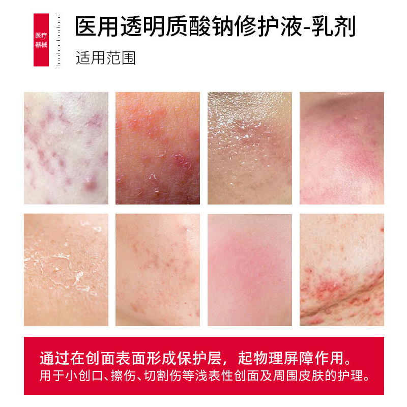 珀芙研医用透明质酸钠修护乳50g 械字号医美术后修护屏障创面愈合