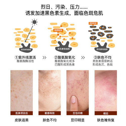 【侯明昊同款】珀芙研传明酸极光亮肤精华氨甲环酸精华液敏感肌 - 图2