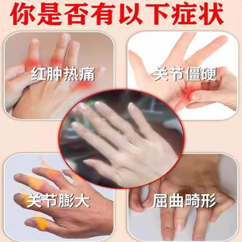 手指关节粗大变形肿大僵硬疼痛专类风湿性关节炎腱鞘炎疼痛药膏PP - 图2