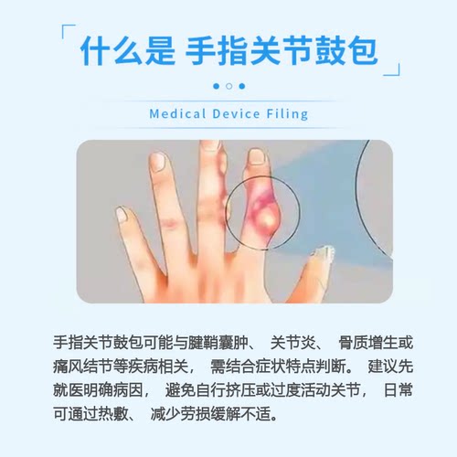 手指关节粗大变形肿大僵硬疼痛专类风湿性关节炎腱鞘炎疼痛药膏PP - 图0