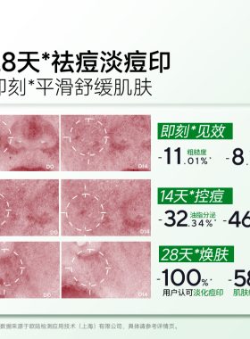 皮宝复合酸果酸精华液30ml