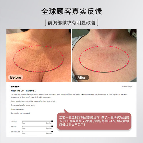 CURRENTBODY焕亮美颈仪红/绿光提亮焕白淡化颈纹紧致胶原光颈纹仪 - 图2