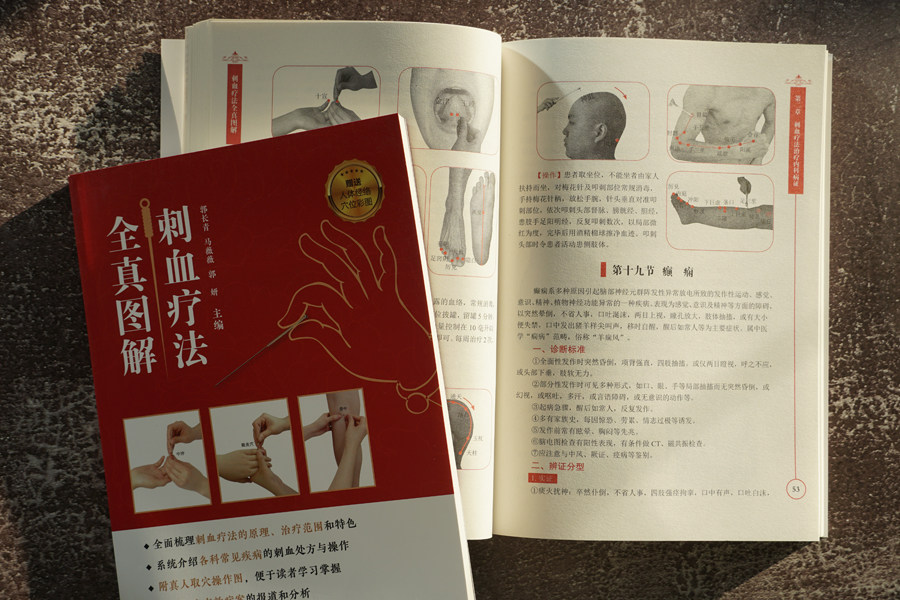 正版刺血疗法全真图解刺血疗法书籍中国刺血疗法大全中医针灸刺络放血疗法刺血治百病放血疗法书籍中医刺络放血疗法图书籍_虎窝淘