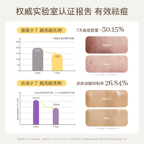 lvk祛痘沐浴露后背去痘男女沐浴乳液香水沐浴露留香男女正品旗舰 - 图3