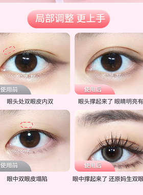 局部双眼皮贴蕾丝超薄隐形自然