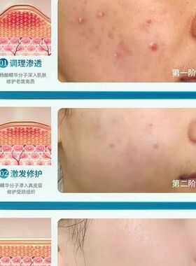 发20片白云山匠后水杨酸面膜净颜清洁毛孔祛痘去黑头粉刺收缩毛孔