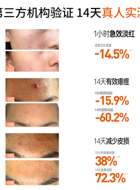 淮树祛痘修护次抛精华液