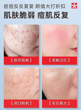 娅芝清肌净颜植物祛痘乳膏壬二酸水杨酸凝胶学生正品旗舰店去豆豆