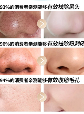 鼻贴去黑头粉刺闭口收缩毛孔套装