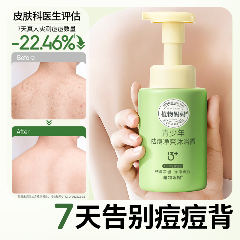 植物妈妈青少年沐浴露儿童13岁+专用男女童祛痘净爽沐浴乳洗发水