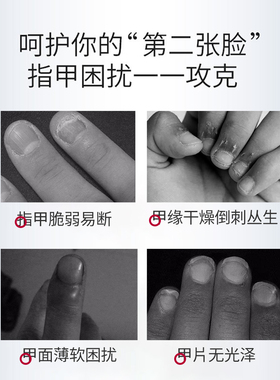 Vinas指甲护理膏边缘脆指甲克星修复滋养美甲官方正品15ml