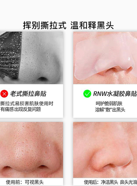 RNW去黑头鼻贴+黑头铲