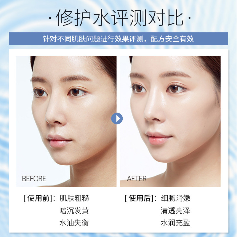 洛魅斯男女补水收缩毛孔控油爽肤水 洛魅斯化妆水/爽肤水