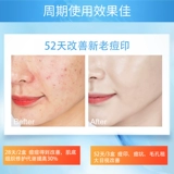 Олигопептид, лиофилизированный порошок, восстанавливающая осветляющая сыворотка для лица, анти-акне, скрывает прыщи, официальный продукт