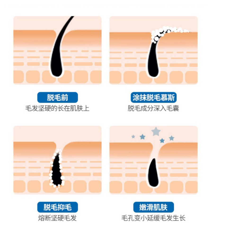 LWDGW融汇丝滑脱毛慕斯腋下腿毛干净不留毛茬黑点温和脱毛膏男女