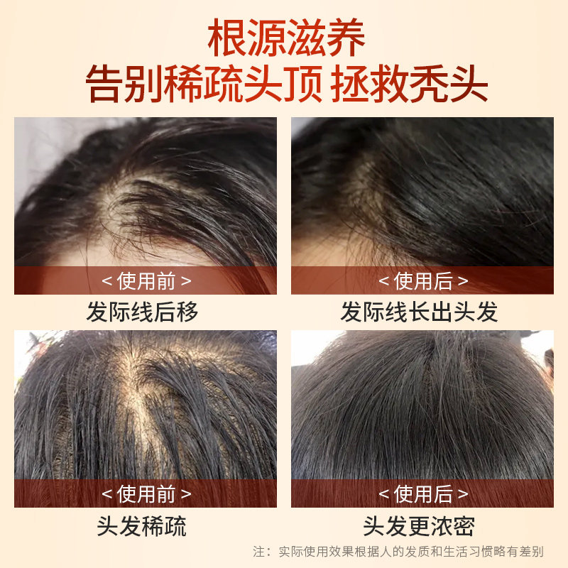 fengle蜂了防脱固发密发滋养育发液 蜂了其它护发