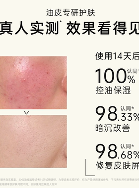 lzq虾青素精粹乳油皮控油舒缓