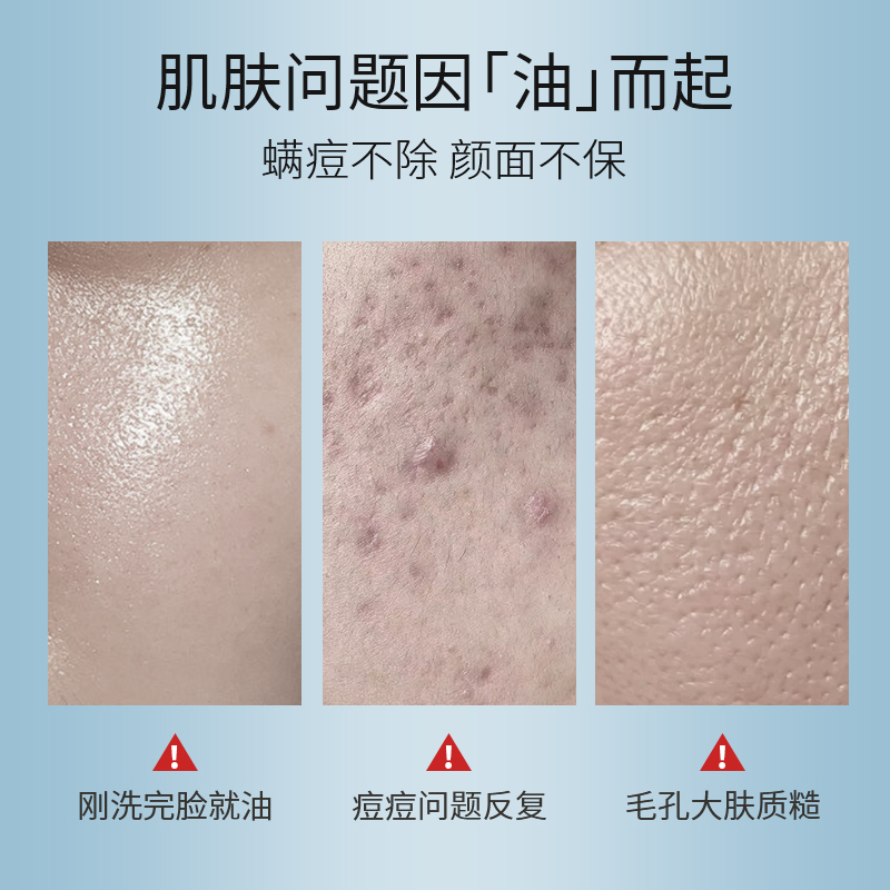 米云男士氨基酸白泥净澈除螨洗面奶 米云化妆品男士洁面