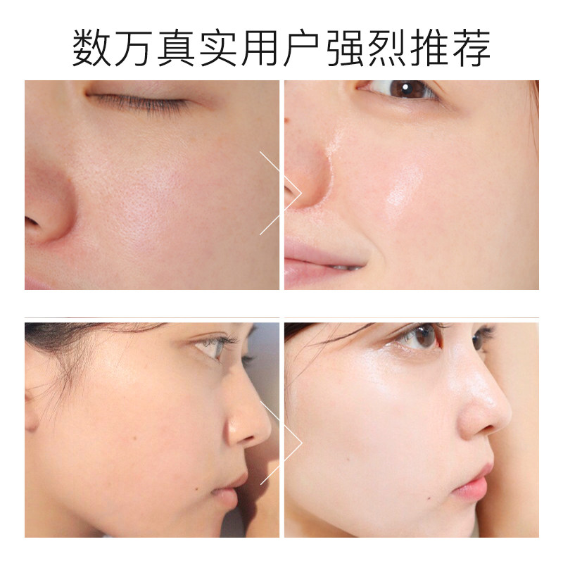 米云焕彩白美嫩肌黄烟酰胺斑精华液 米云化妆品液态精华