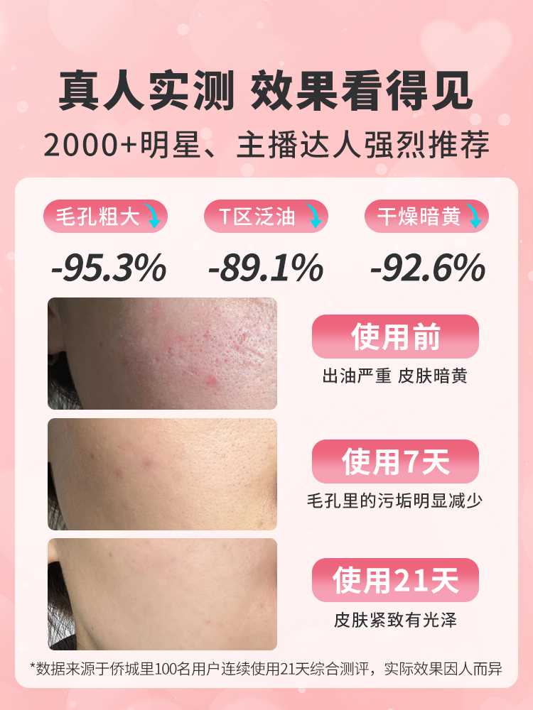 蒸脸器冷热双喷蒸脸仪脸部家用纳米喷雾补水仪美容蒸汽机打开毛孔-图1