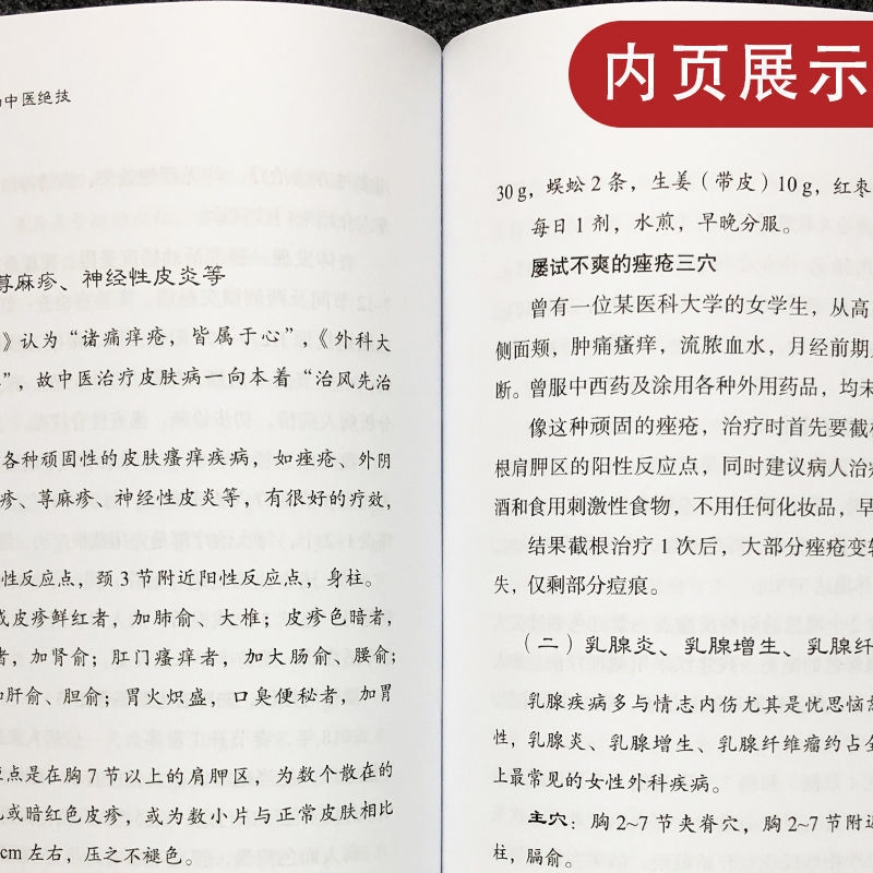 截根疗法第二2版 濒临失传的中医绝技 中医疗法调理 癌症恶性肿瘤肝胆病银屑病不孕症治疗 中医内科外科五官科肿瘤妇科疾病诊治 - 图0