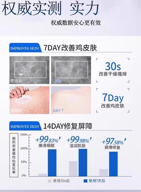 改善暗沉鸡皮淡化黑色素