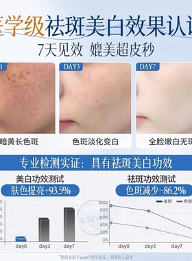 377美白祛斑面霜淡化色斑正品