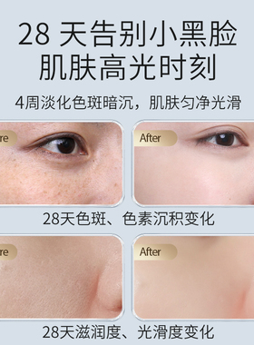 安牧丹茶白臻效美白淡斑精华水