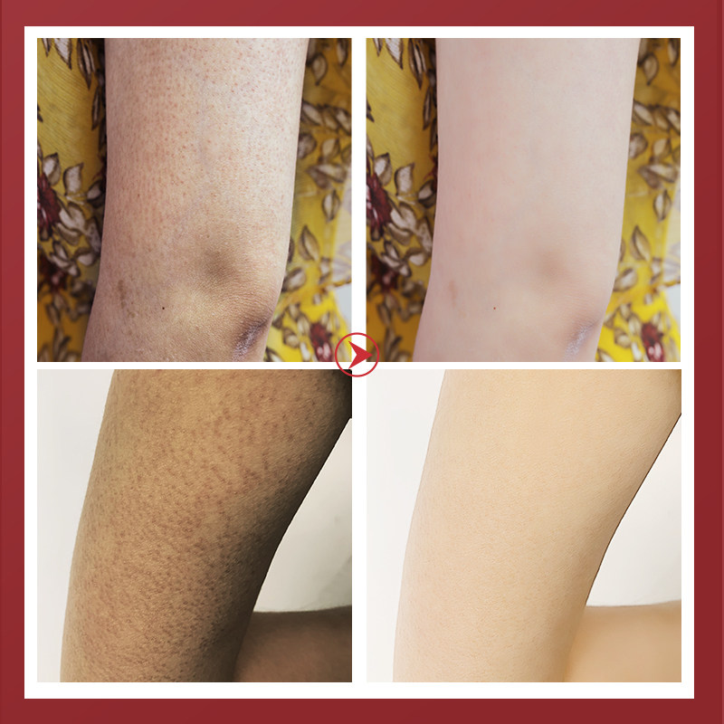 搓泥宝去角质全身美白搓澡泥女膏 昭亮家居搓泥浴宝