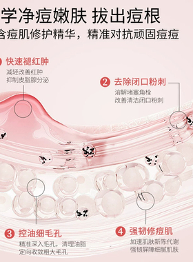 【药房同售】15%壬二酸祛痘凝胶