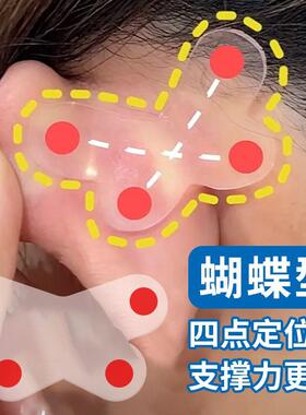 隐形显脸小不翘边蝴蝶耳贴