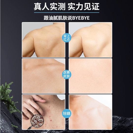 Одеколонское специальное мужское мыло контролирует жирность и удаляет клещей.