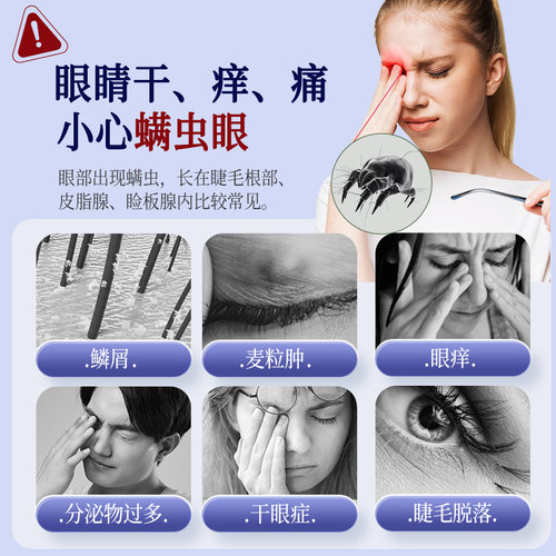 茶树精油除螨湿巾眼睛眼贴眼部螨虫4-松油醇专用眼睑清洁眼 - 图1